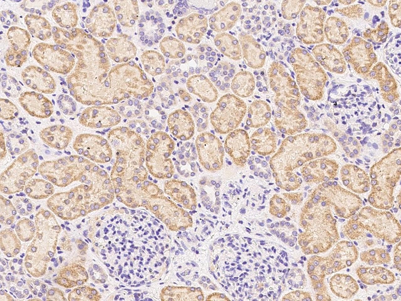 Polyclonal Rabbit anti-Human CD119 / IFNGR1 Antibody (Preservative Free, IHC, WB)
