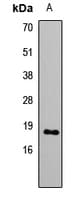 GNRH2 Antibody