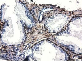 QPRT Antibody (clone OTI1C10, Carrier-free)