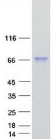 Human ALPI / Alkaline Phosphatase Protein (Recombinant Myc-DDK (Flag))