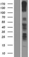 PCDH11X / Protocadherin 11 Protein (Over-Expression Lysate Myc-DDK (Flag))