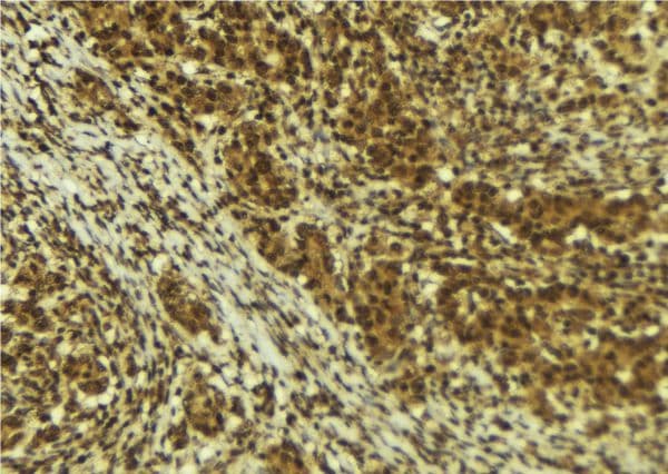 BRD4 Antibody