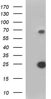 Monoclonal Mouse anti-Human VEGFB Antibody (clone OTI2C4, IHC, WB)
