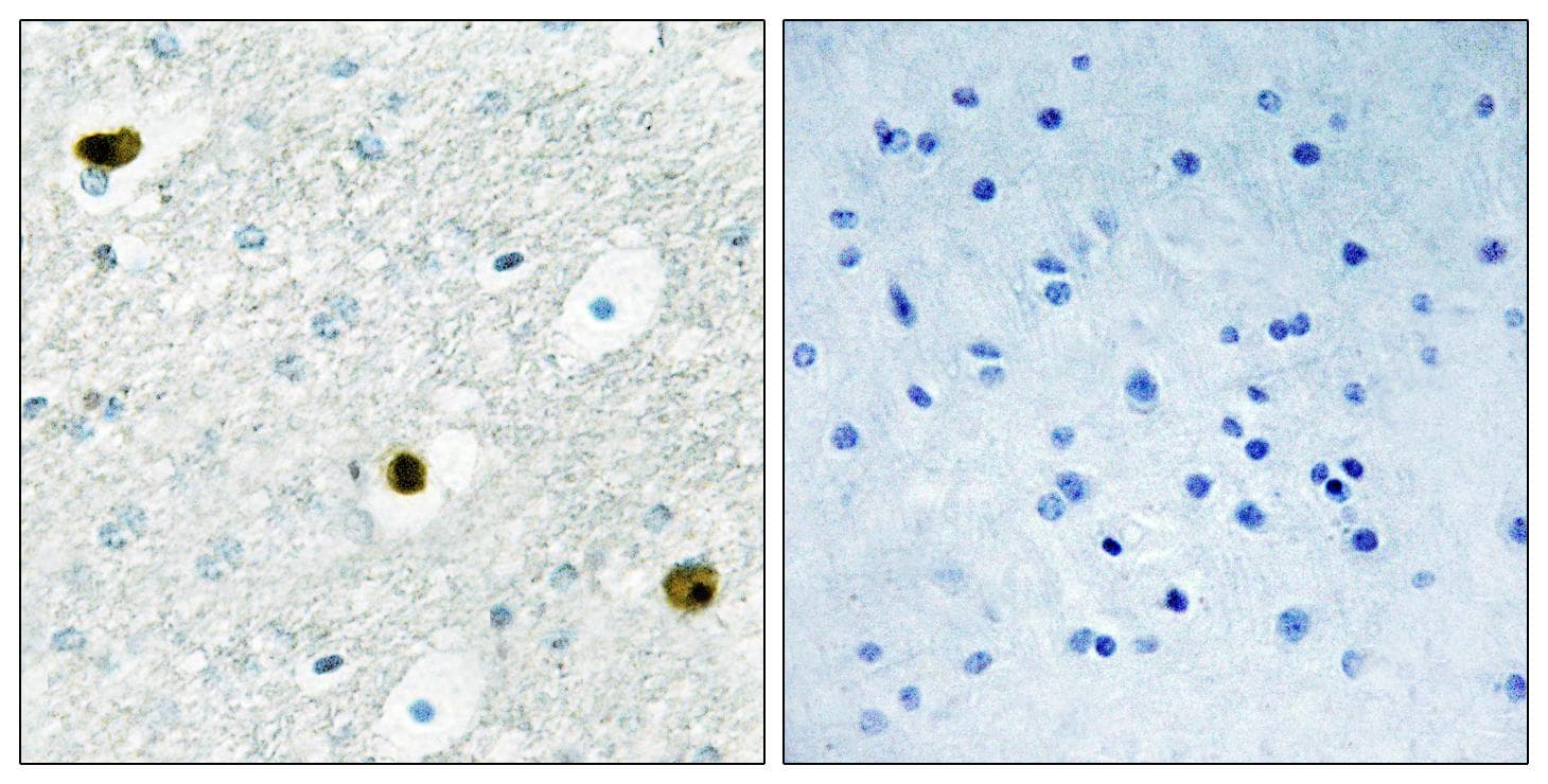 D52 / TPD52 Antibody