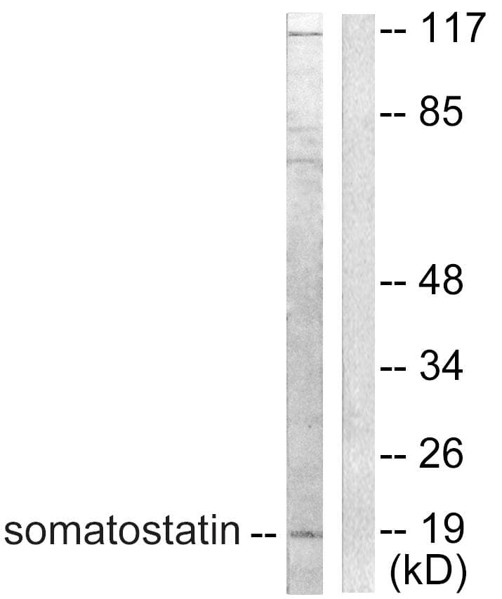 SST / Somatostatin Antibody
