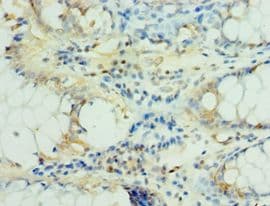 Polyclonal Rabbit anti-Human MS4A12 Antibody (aa1-90, IHC)