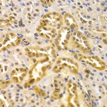 MAPK7 / ERK5 Antibody