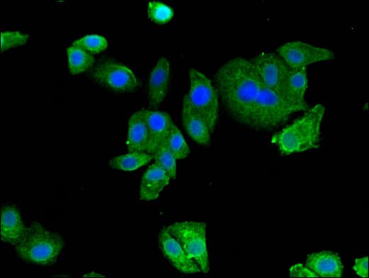 IHC-plus™ Polyclonal Rabbit anti-Human AMPD2 Antibody (IHC, IF)