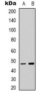 Polyclonal Rabbit anti-Human TCFL5 Antibody (C-Terminus, IHC, WB)