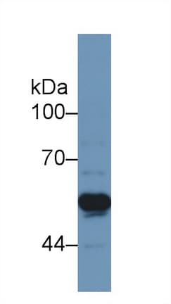 TNFRSF1A / TNFR1 Antibody (aa43-194)