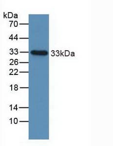 IGFBP2 / IGF-BP53 Antibody (aa148-325, FITC)