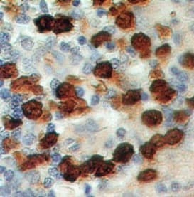 S100A8 / MRP8 Antibody (aa2-82, clone 48M7F9, Azide-free)