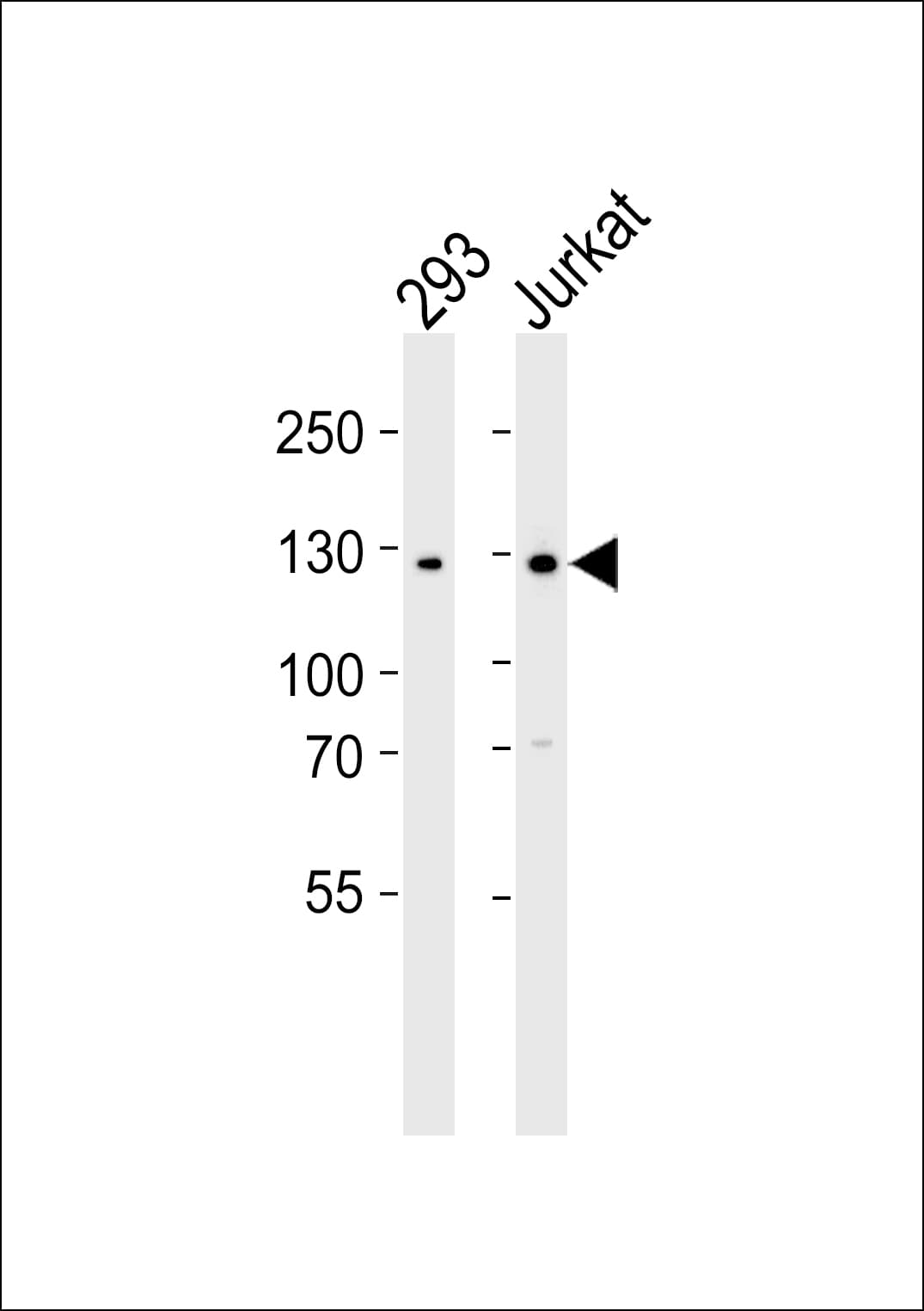 Polyclonal Rabbit anti-Human GLI2 Antibody (aa1287-1321, IF, WB)