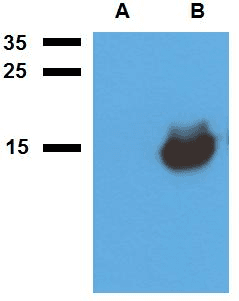 Mycobacterium tuberculosis Acr1 Antibody (clone Polyclonal)