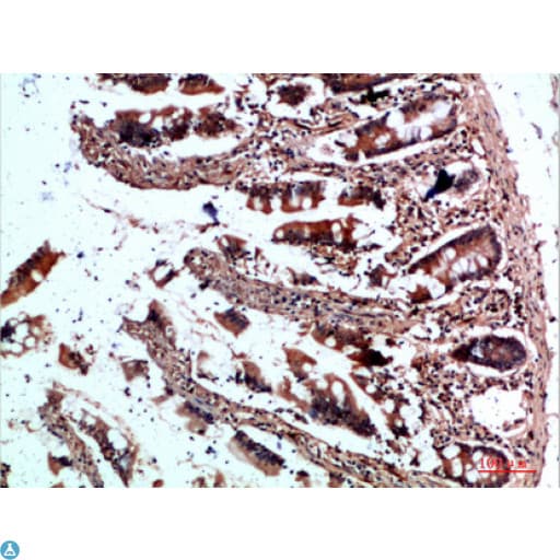 CYFIP2 / PIR121 Antibody