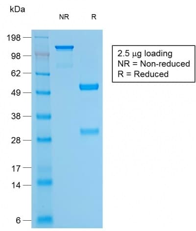 PathPlus™ BCL2 / Bcl-2 Antibody (clone BCL2/1878R)