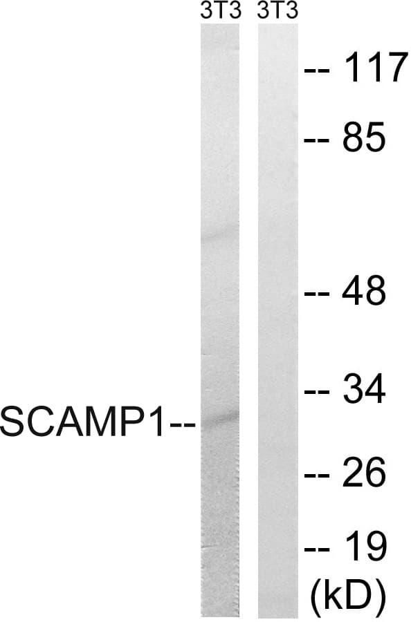 SCAMP1 / SCAMP Antibody (aa273-322)