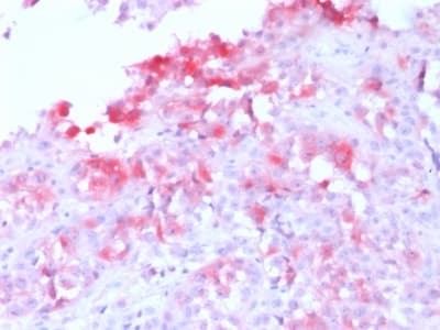 MLANA / Melan-A Antibody (clone MLANA/1761R, Azide-free, Carrier-free)