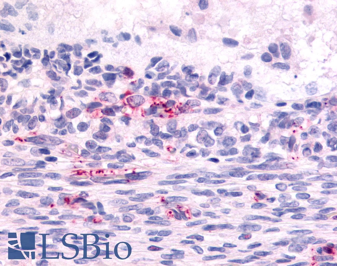 IHC-plus™ ADGRL2 / LPHN2 Antibody (N-Terminus)