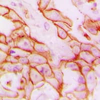 ITGB3 / Integrin Beta 3 / CD61 Antibody (C-Terminus)