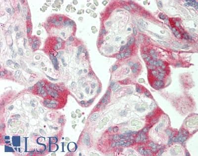 IHC-plus™ FBLN1 / Fibulin 1 Antibody (Internal)
