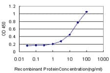 MKNK2 / MNK2 Antibody (clone 4F11)