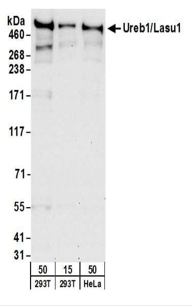 HUWE1 / ARFBP1 Antibody (aa2250-2300)