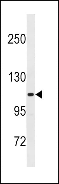 Polyclonal Rabbit anti-Human THBS4 / Thrombospondin 4 Antibody (aa932-961, WB)