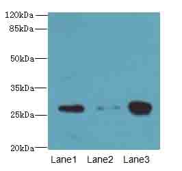 KHDC1 / C6orf148 Antibody