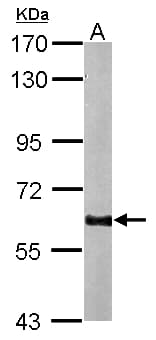 Polyclonal Rabbit anti-Human GAD65 Antibody (aa465-558, IHC, WB)