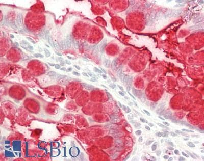 PathPlus™ TFF3 / Trefoil Factor 3 Antibody