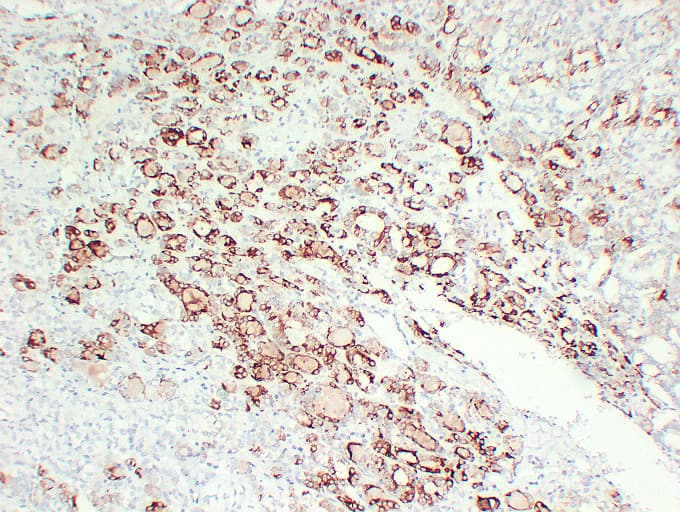 PathPlus™ TPO / Thyroid Peroxidase Antibody