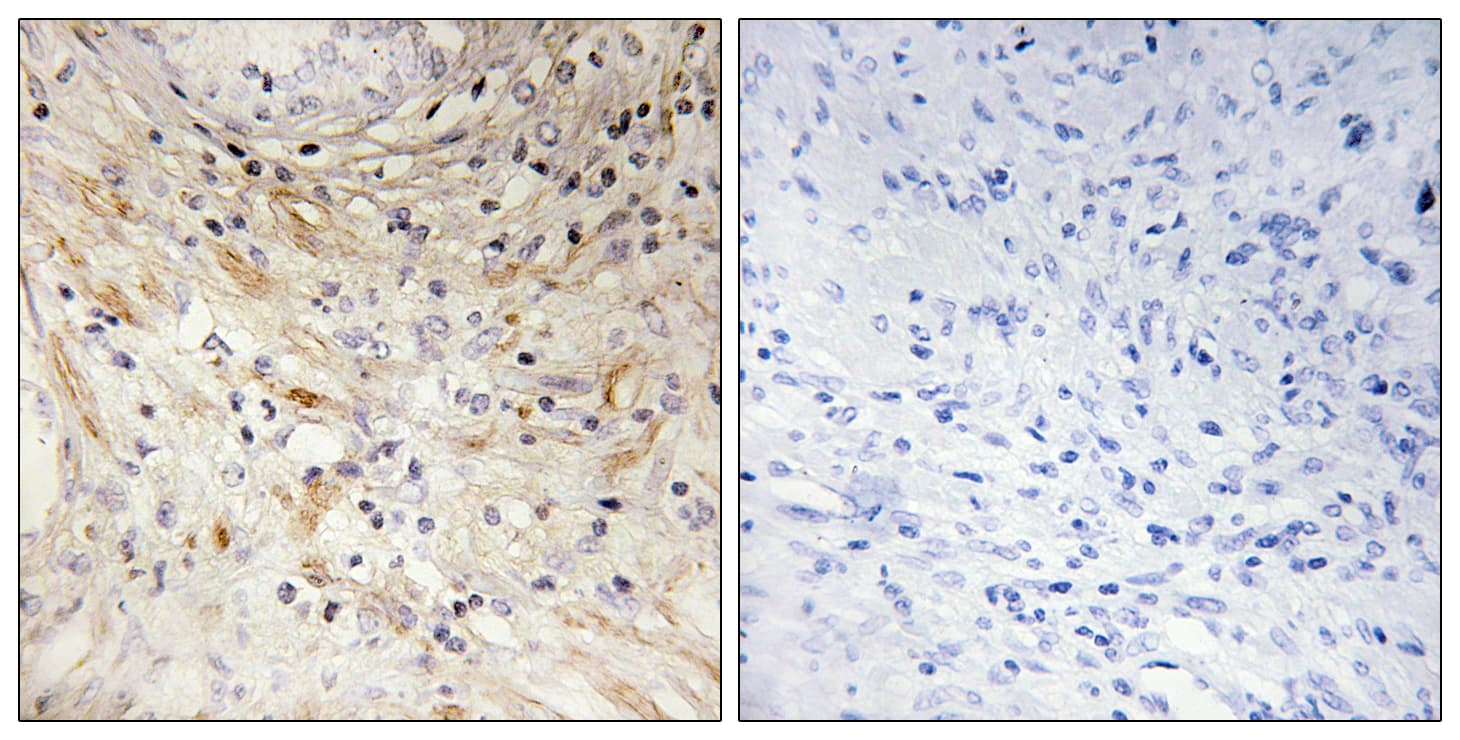 Polyclonal Rabbit anti-Human LAMB3 / Laminin Beta 3 Antibody (aa671-720, IHC, IF)