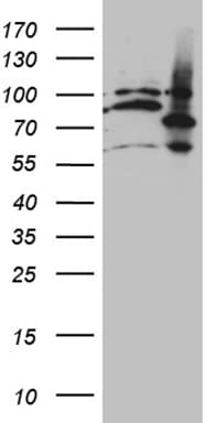 MAK Antibody (aa291-623, clone OTI5A7)