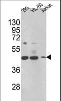 HSD17B7 / PRAP Antibody (aa57-85)