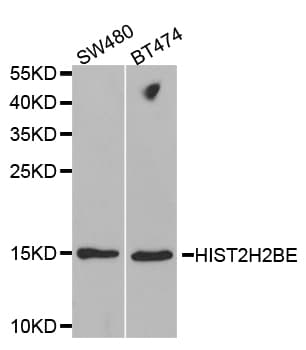Polyclonal Rabbit anti-Human HIST2H2BE Antibody (IHC, WB)