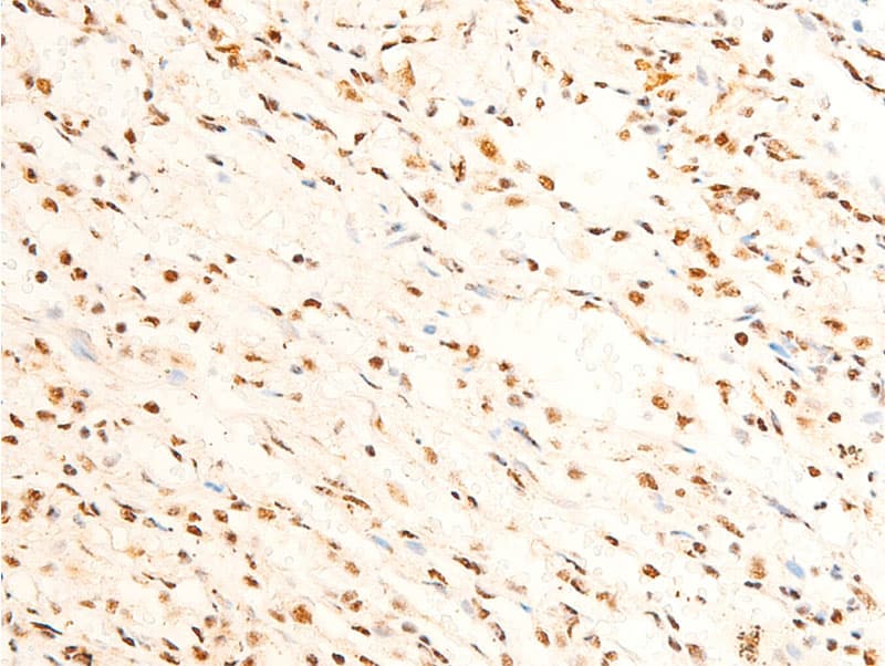 Polyclonal Rabbit anti-Human FOXO3 / FOXO3A Antibody (phospho-Ser253, IHC, WB)