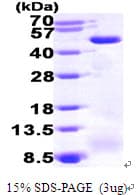 Human MCAD / ACADM Protein (Recombinant His)
