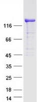 Human DIAPH1 Protein (Recombinant Myc-DDK (Flag))
