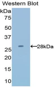 Latexin / MUM Antibody (aa1-222)