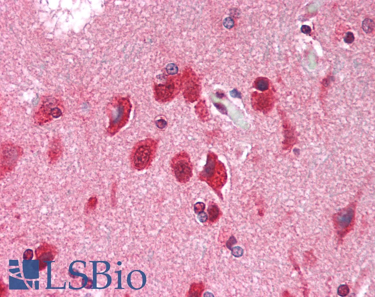 IHC-plus™ METTL14 Antibody