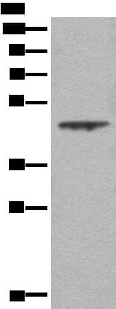 Polyclonal Rabbit anti-Human ASS1 / ASS Antibody (IHC, WB)