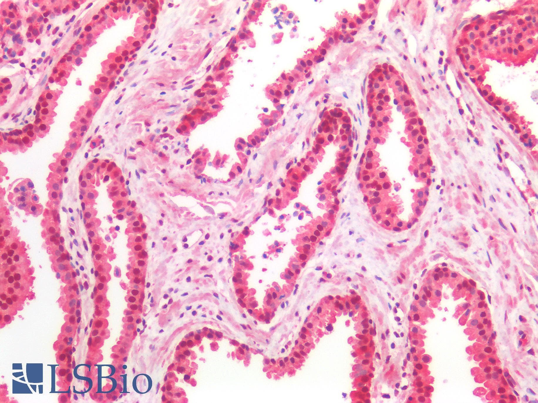IHC-plus™ Polyclonal Rabbit anti-Human PARK7 / DJ-1 Antibody (IHC, IF, WB)