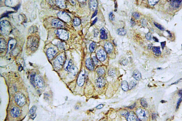 Polyclonal Rabbit anti-Human NPY5R Antibody (Met264, IHC, IF, WB)