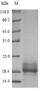 Human SPRR2B Protein (Recombinant 10His, N-terminus + Myc, C-terminus)