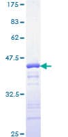 Human YY1 Protein (Recombinant GST, N-terminus)