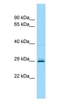 Polyclonal Rabbit anti-Human CEMP1 Antibody (aa136-185, WB)