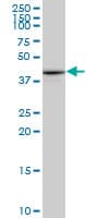Monoclonal Mouse anti-Human PTX3 / Pentraxin 3 Antibody (clone 5B7, WB)