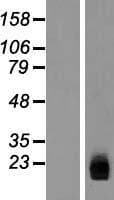 ZNHIT3 Protein (Over-Expression Lysate Myc-DDK (Flag))
