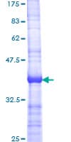 Human API5 Protein (Recombinant GST, N-terminus)